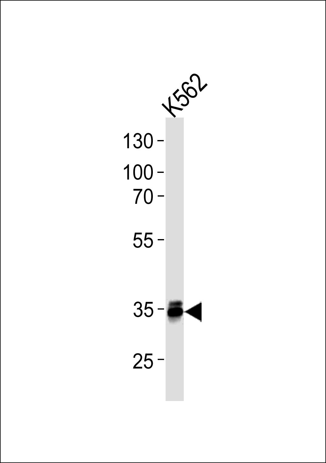 Mouse anti-MBD3 Monoclonal Antibody(C-term)(995CT3.2.2)