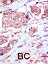 Rabbit anti-EphB6 Polyclonal Antibody(C-term H990)