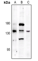 Rabbit anti-PERK(pT982) Polyclonal Antibody