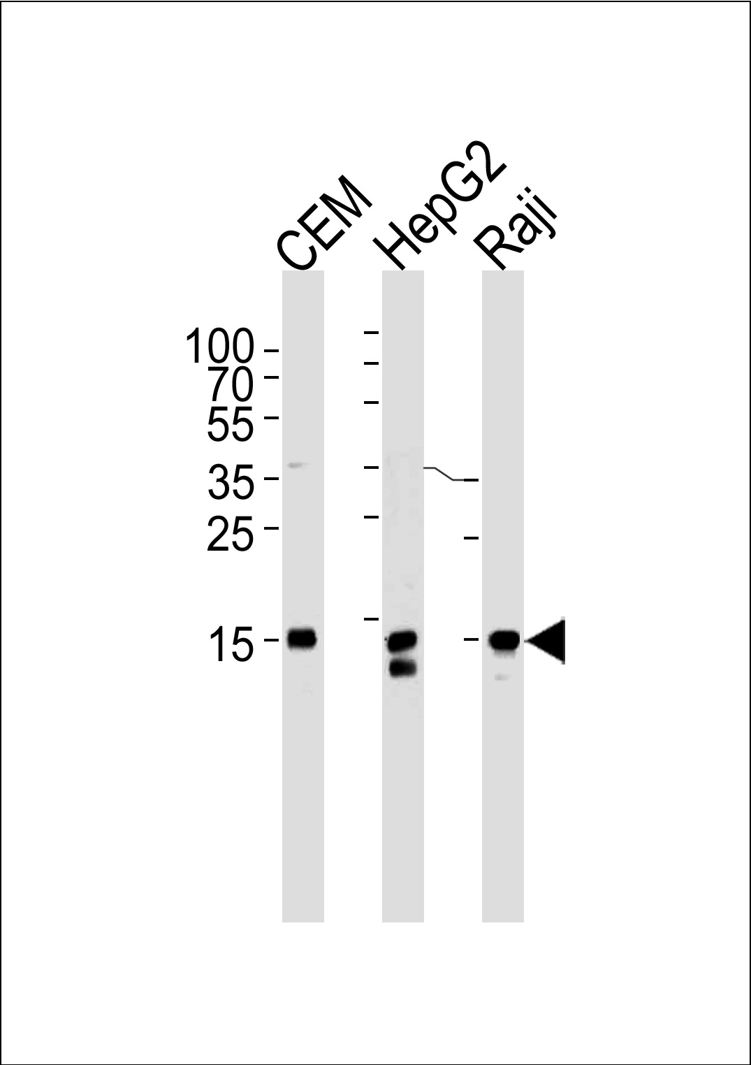 Mouse anti-H2AFX Monoclonal Antibody(N-term)(980CT1.5.5)
