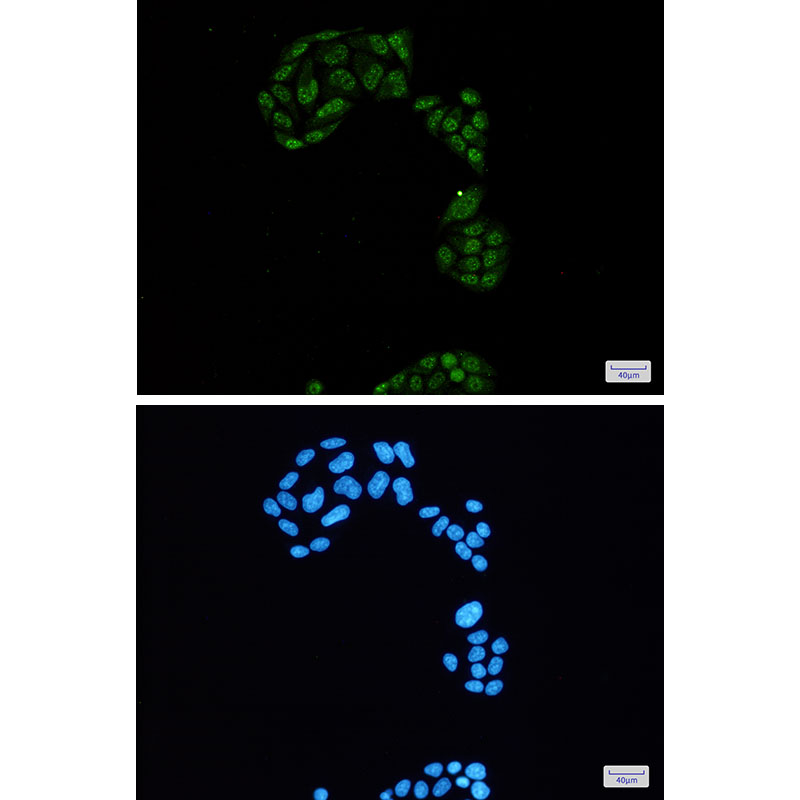 Rabbit anti-Phospho-Rb2 p130(Ser952) Monoclonal Antibody(5D6)