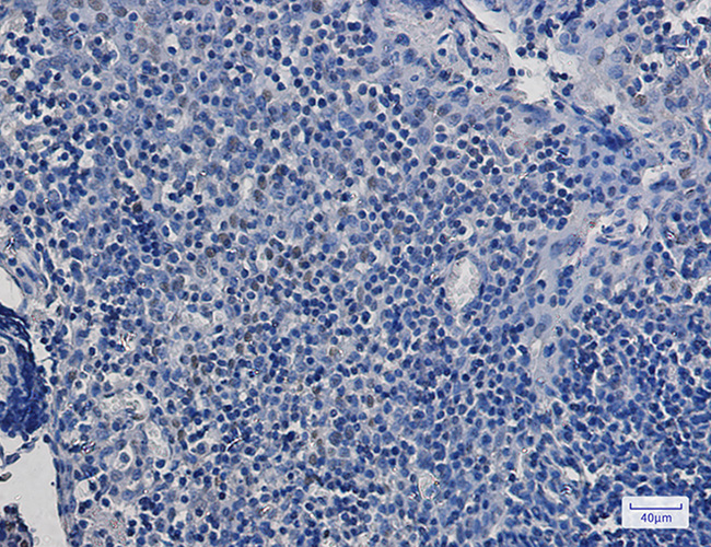Rabbit anti-Phospho-Rb2 p130(Ser952) Monoclonal Antibody(5D6)