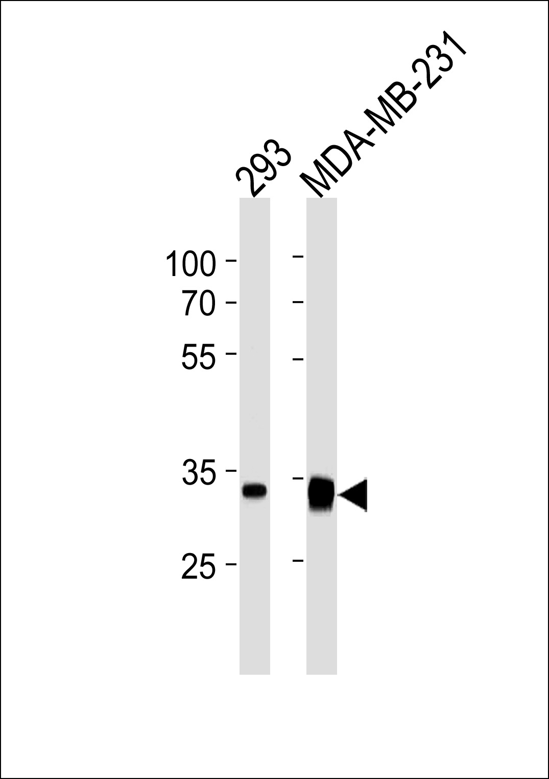 Mouse anti-GOLPH3 Monoclonal Antibody(C-term)(921CT14.2.1)
