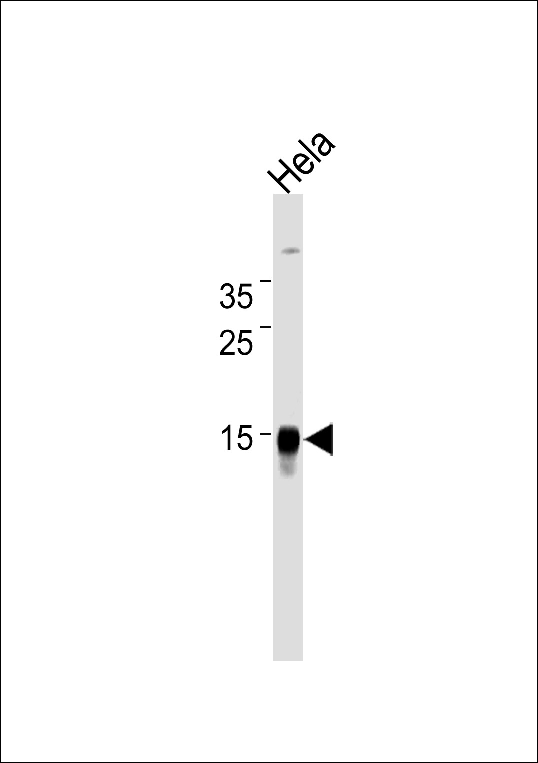 Mouse anti-CDA Monoclonal Antibody(Center)(921CT14.2.1)