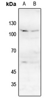 Rabbit anti-NMDAR1(pS896) Polyclonal Antibody