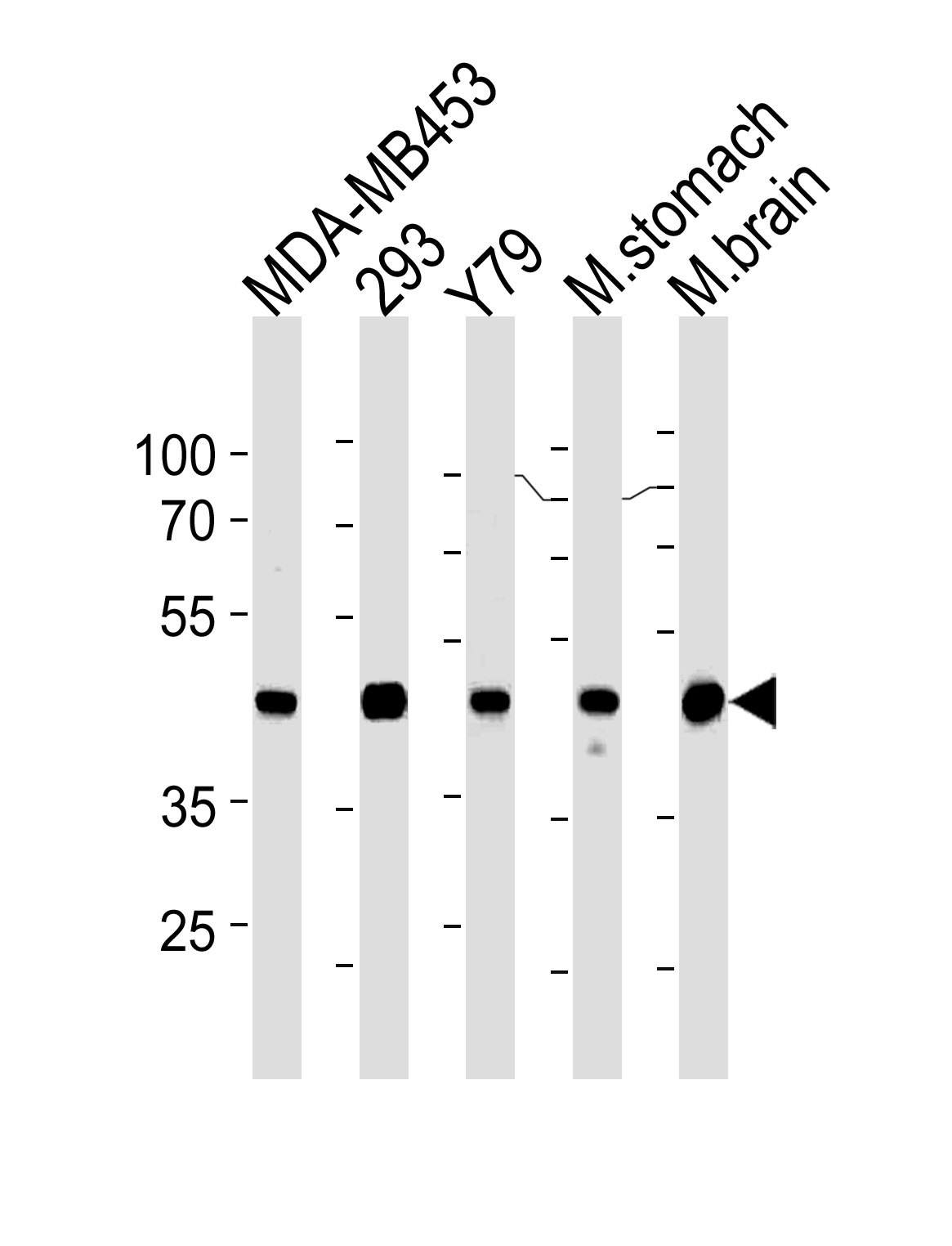 Mouse anti-Creatine Kinase BB Monoclonal Antibody(Center)(893CT29.1.1)