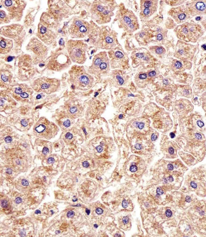 Mouse anti-CTSD Monoclonal Antibody(892CT11.1.1)