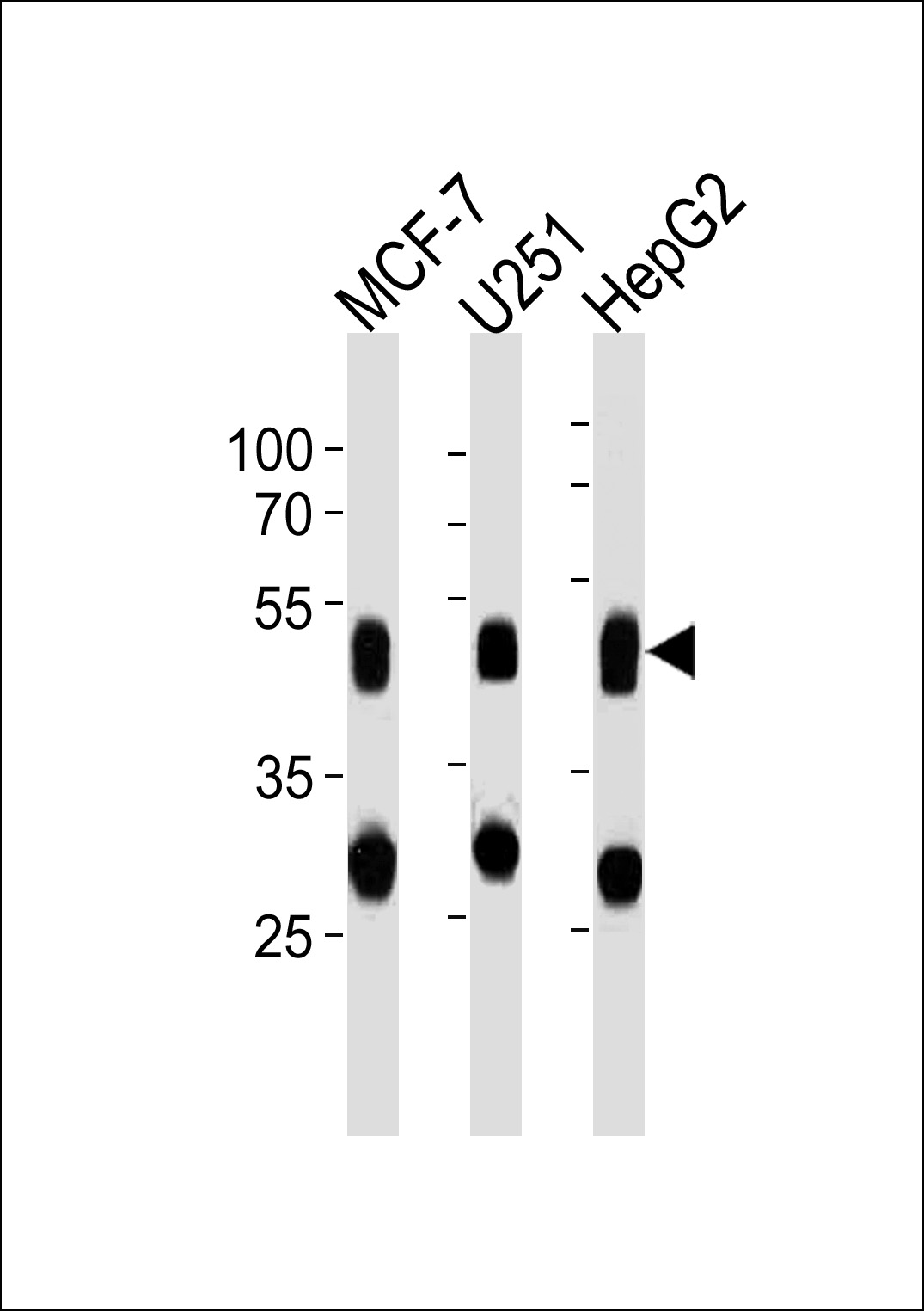 Mouse anti-CTSD Monoclonal Antibody(892CT11.1.1)