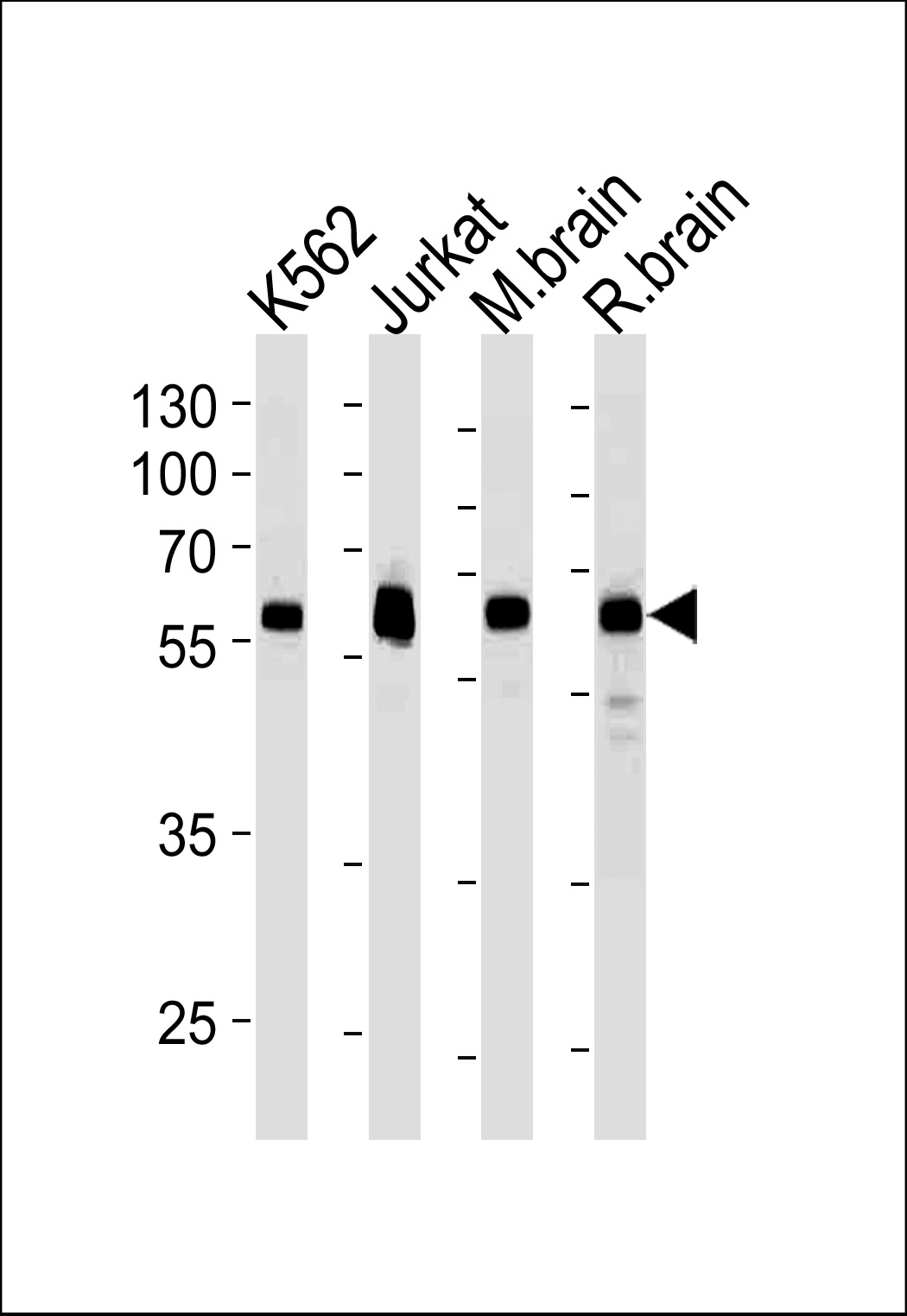 Mouse anti-USP14 Monoclonal Antibody(N-term)(889CT6.2.1)