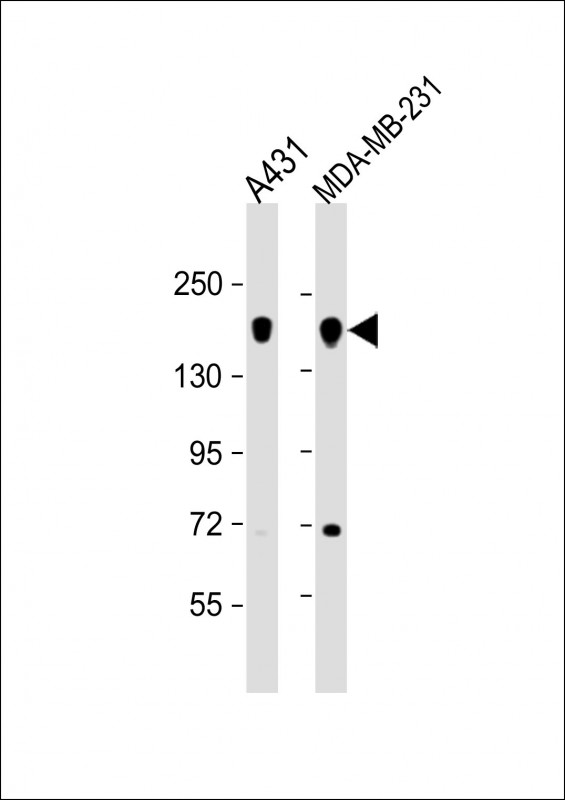 Rabbit anti-EGFR Polyclonal Antibody(Y869)