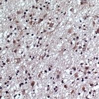 Rabbit anti-GLUR1(pS863) Polyclonal Antibody