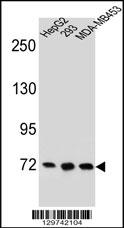 Rabbit anti-ZNF860 Polyclonal Antibody(C-term)