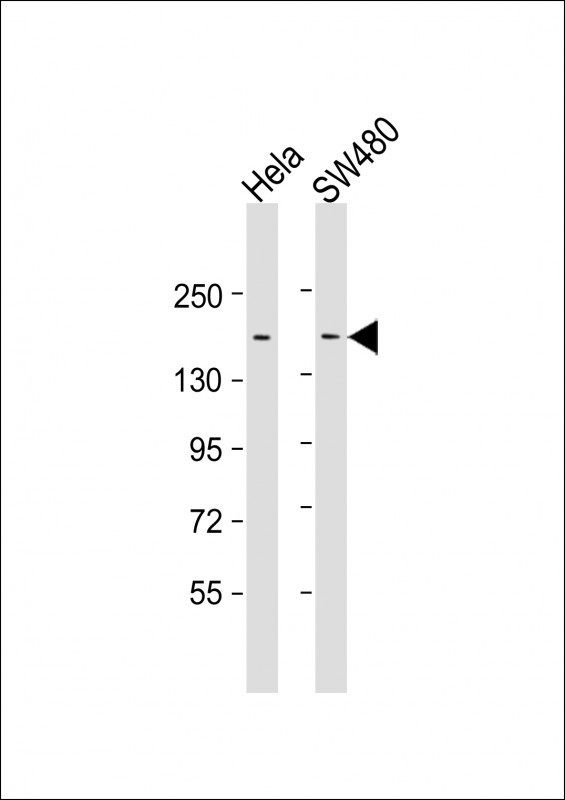 Mouse anti-LAP2 Monoclonal Antibody(1617CT859.9.32)