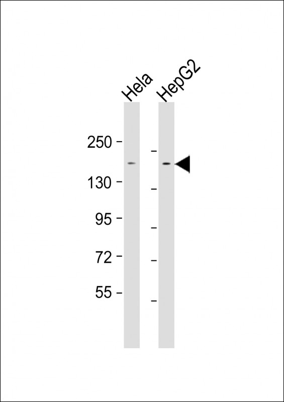Mouse anti-LAP2 Monoclonal Antibody(1617CT859.9.32)
