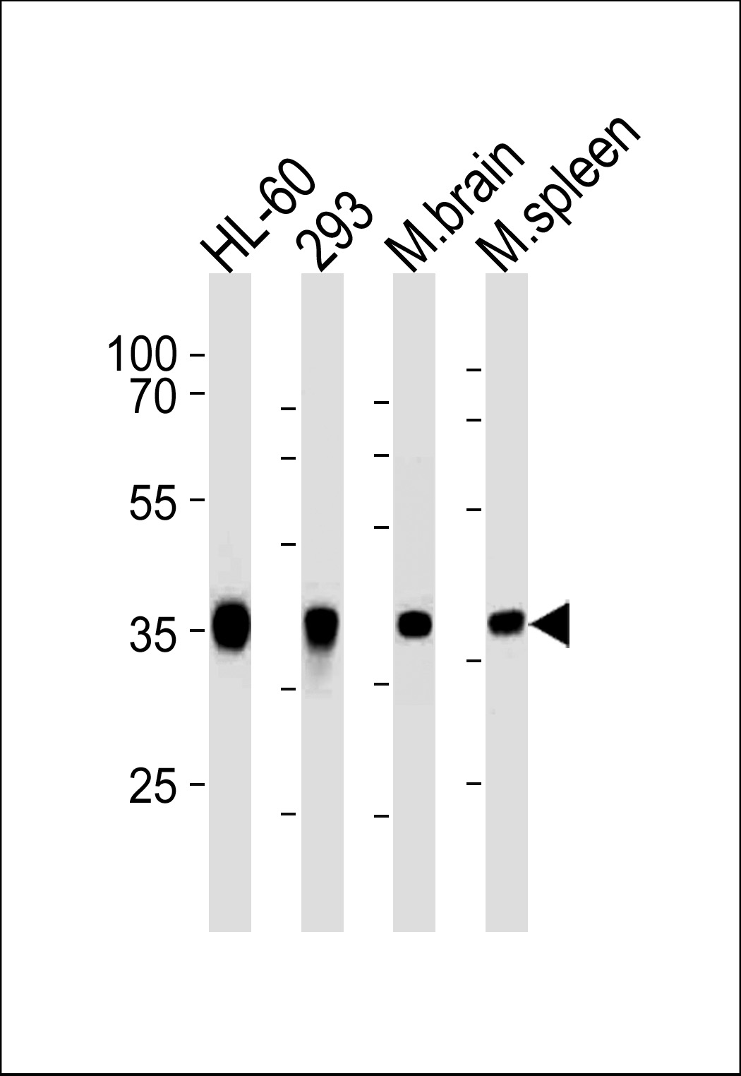 Mouse anti-ALDOC Monoclonal Antibody(C-term)(859CT9.5.3)