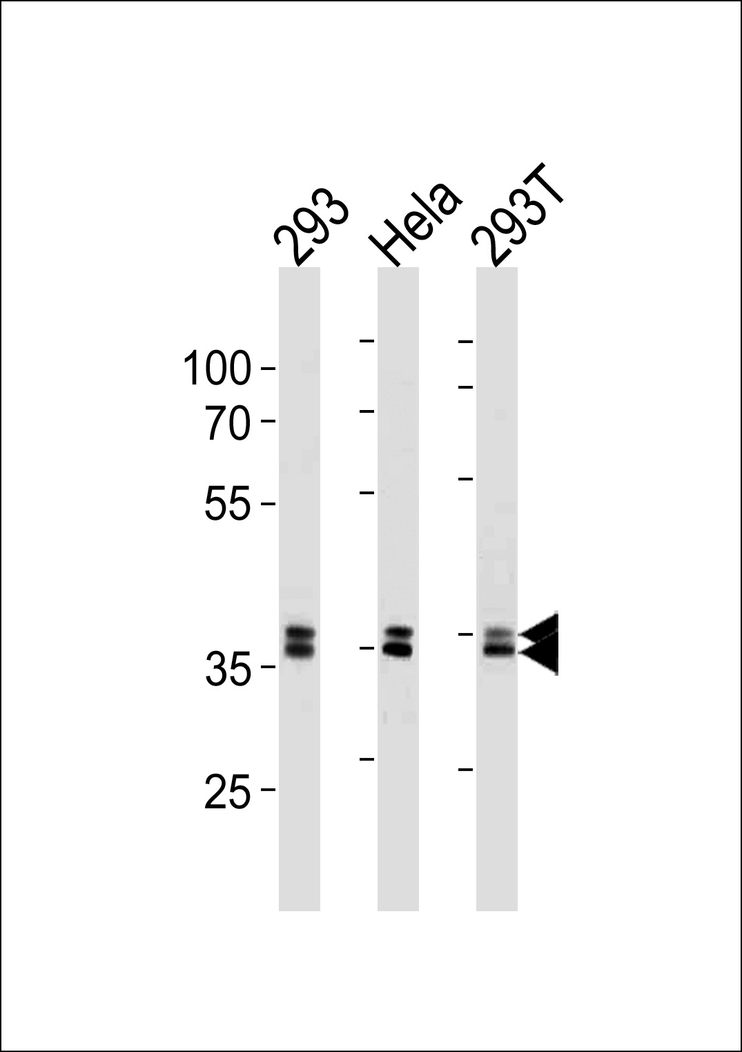 Mouse anti-UCH37 Monoclonal Antibody(N-term)(854CT5.5.6)