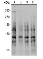 Rabbit anti-E Cadherin(pS844) Polyclonal Antibody
