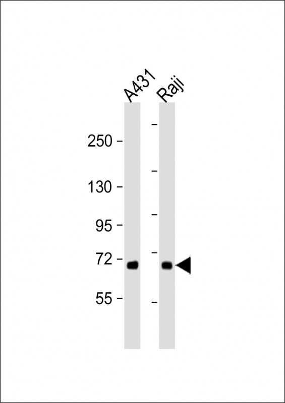 Rabbit anti-MAP3K5(T842)Polyclonal Antibody