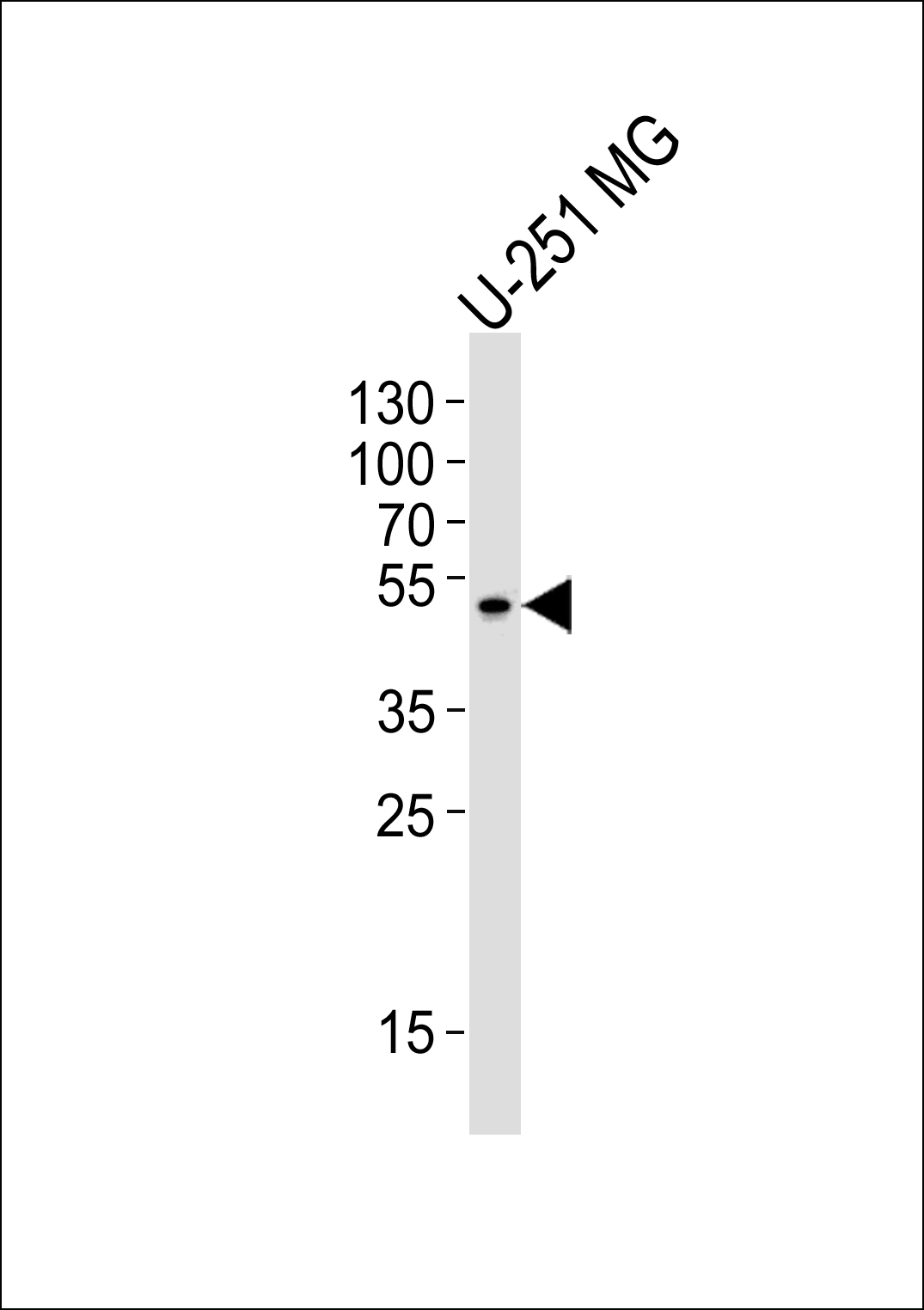 Rabbit anti-ZNF830 Polyclonal Antibody(Center)