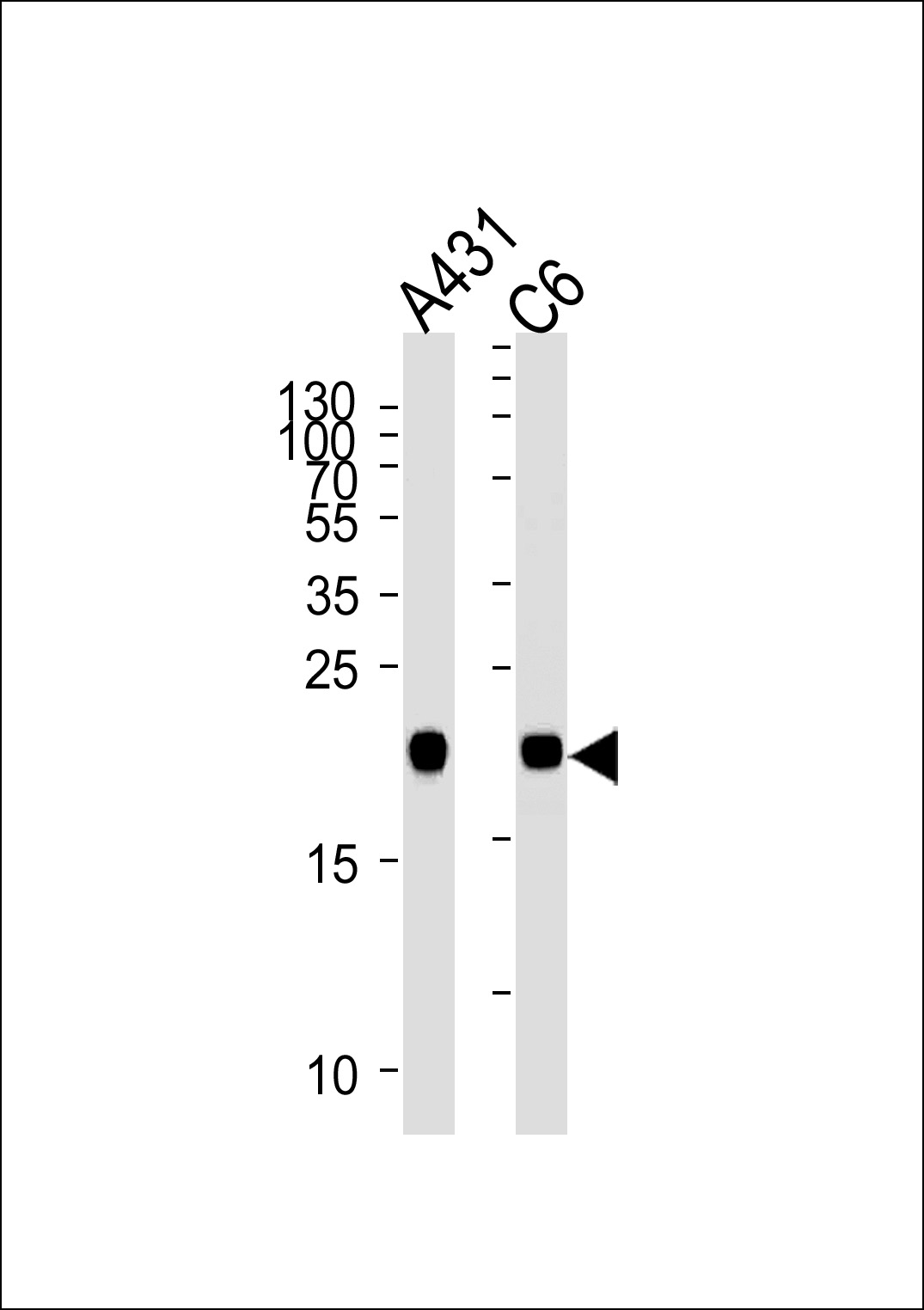 Mouse anti-NRAS Monoclonal Antibody(N-term)(822CT17.5.1)