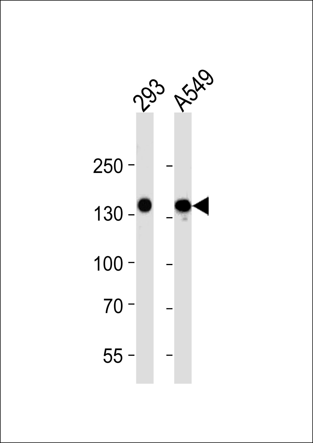 Mouse anti-VEGFR3 Monoclonal Antibody(818CT12.1.1)