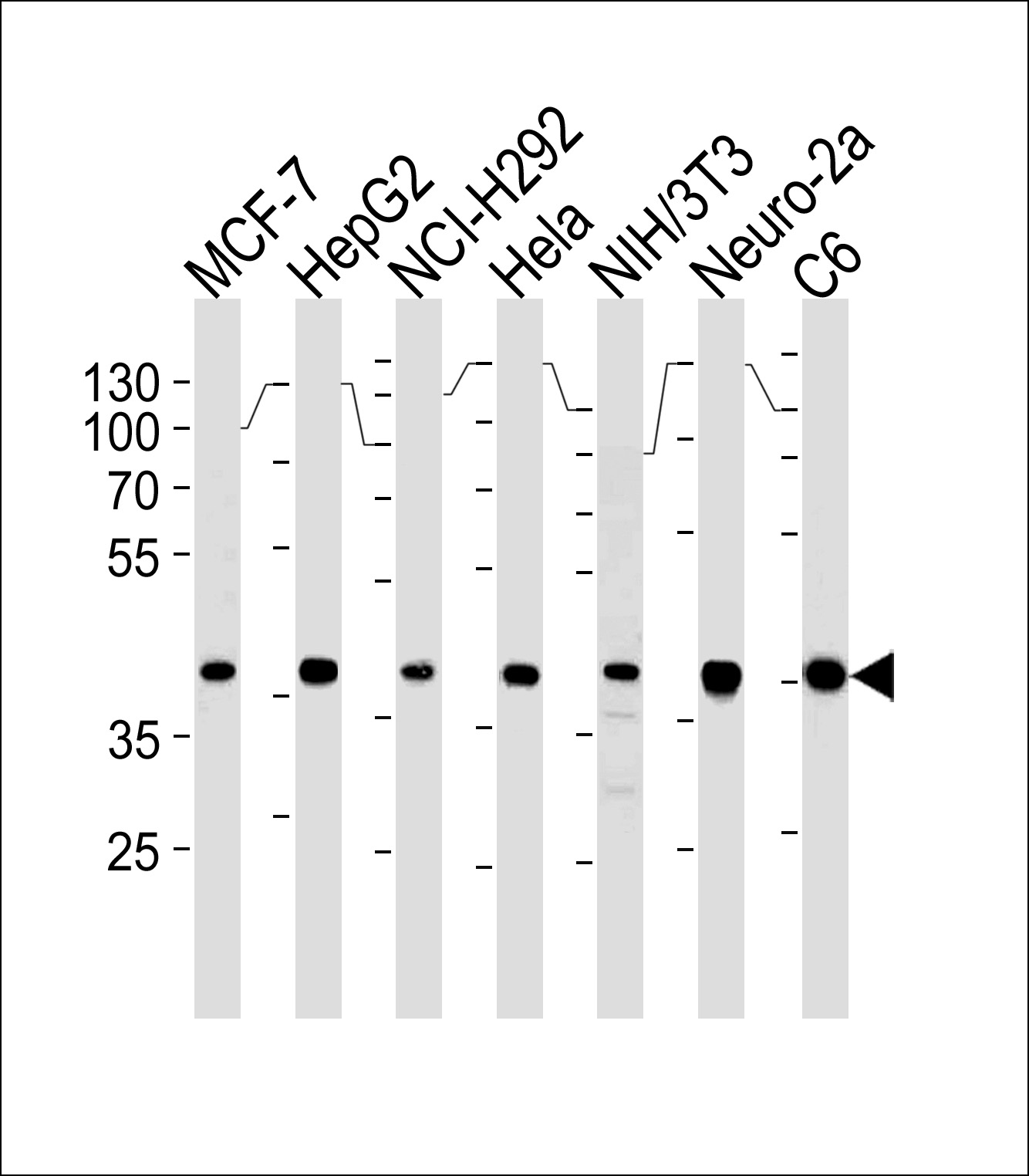 Mouse anti-Erk2 Monoclonal Antibody(814CT5.4.2)