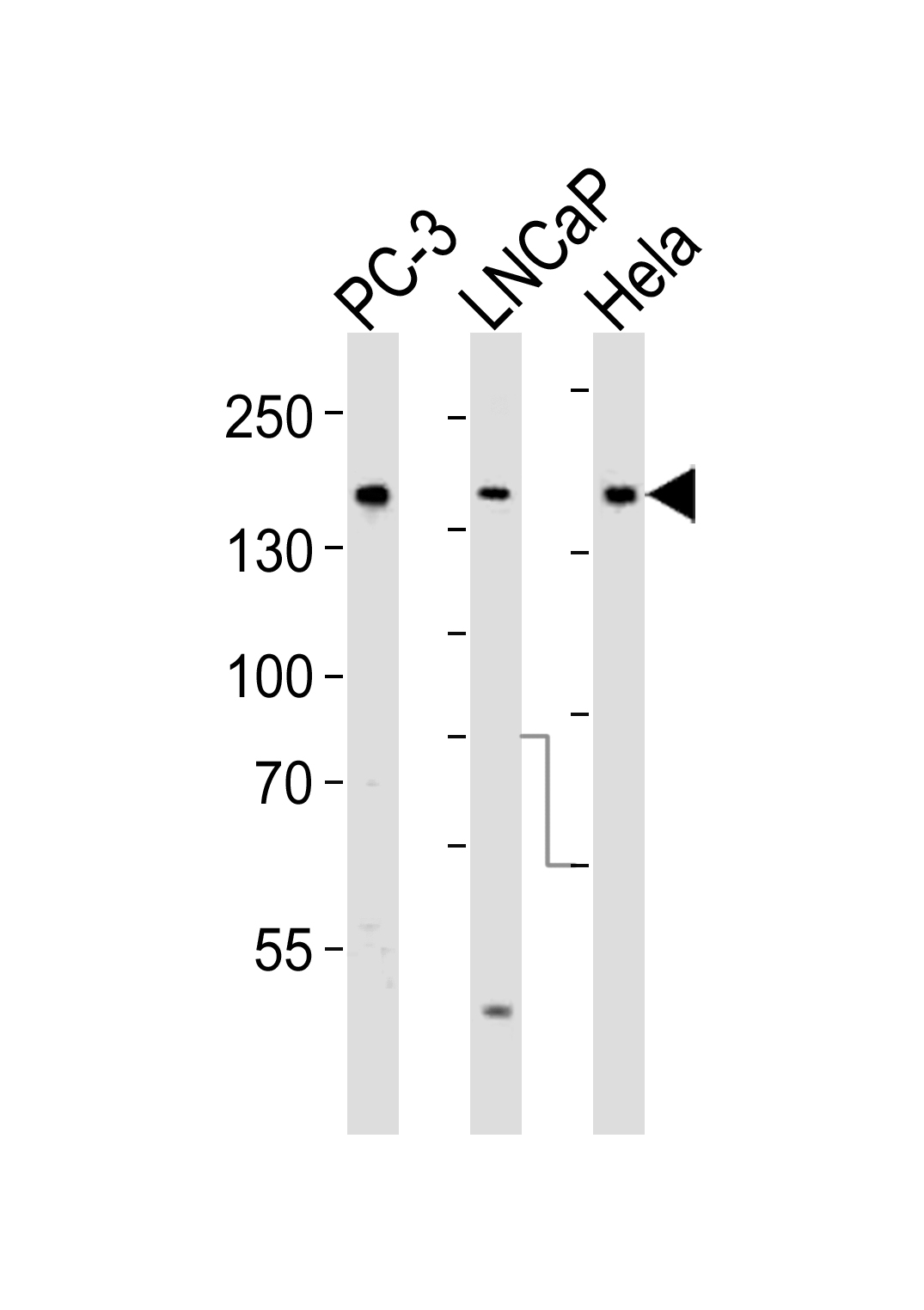 Rabbit anti-Tuberin Polyclonal Antibody(S1798)