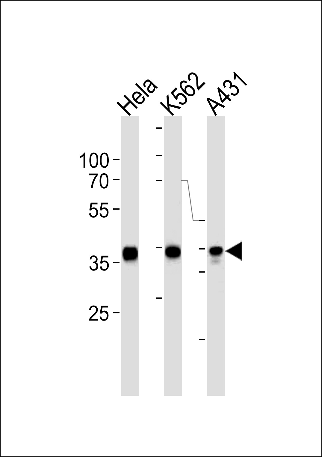 Mouse anti-ANXA1 Monoclonal Antibody(794CT2.2.1)