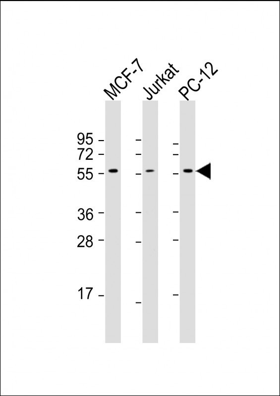 Mouse anti-AKT2 Monoclonal Antibody(1623CT791.157.67.66)