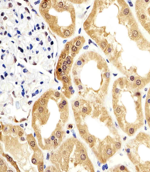 Mouse anti-ENO1 Monoclonal Antibody(786CT6.6.4)