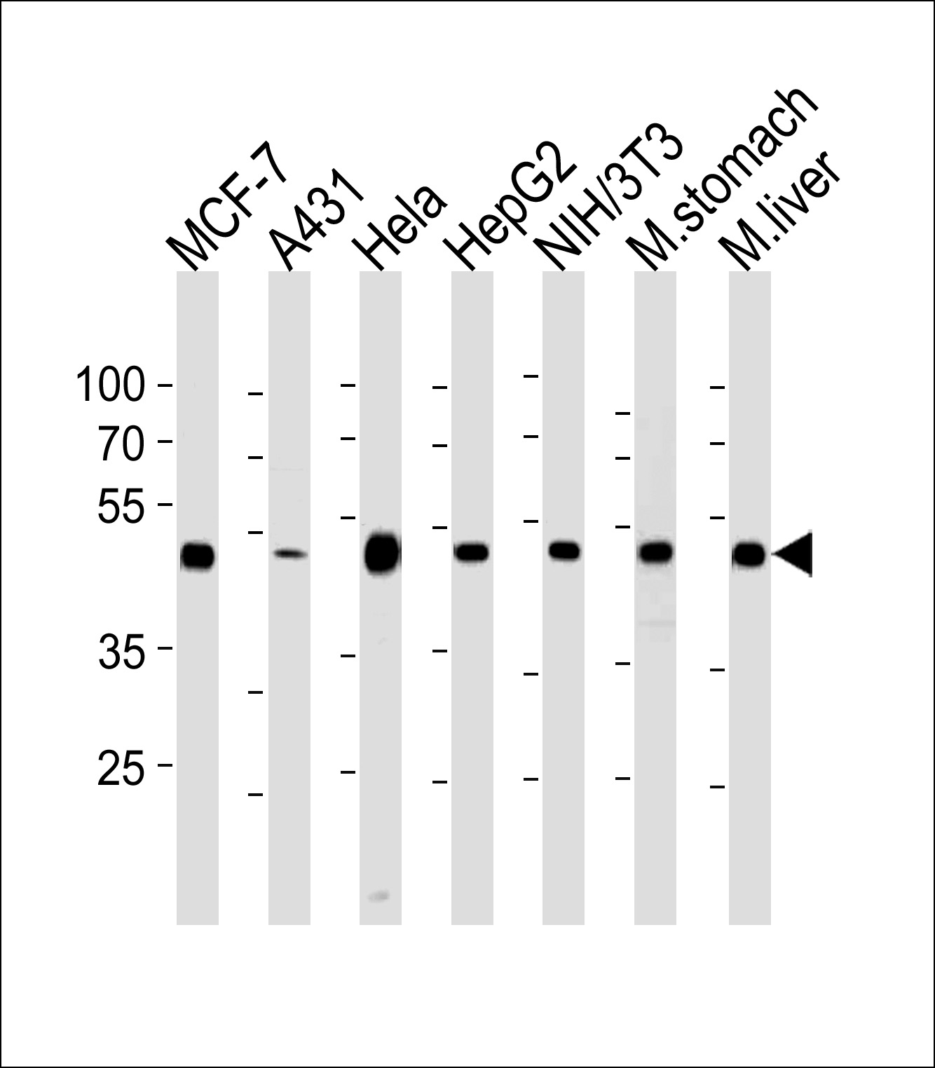 Mouse anti-ENO1 Monoclonal Antibody(786CT6.6.4)