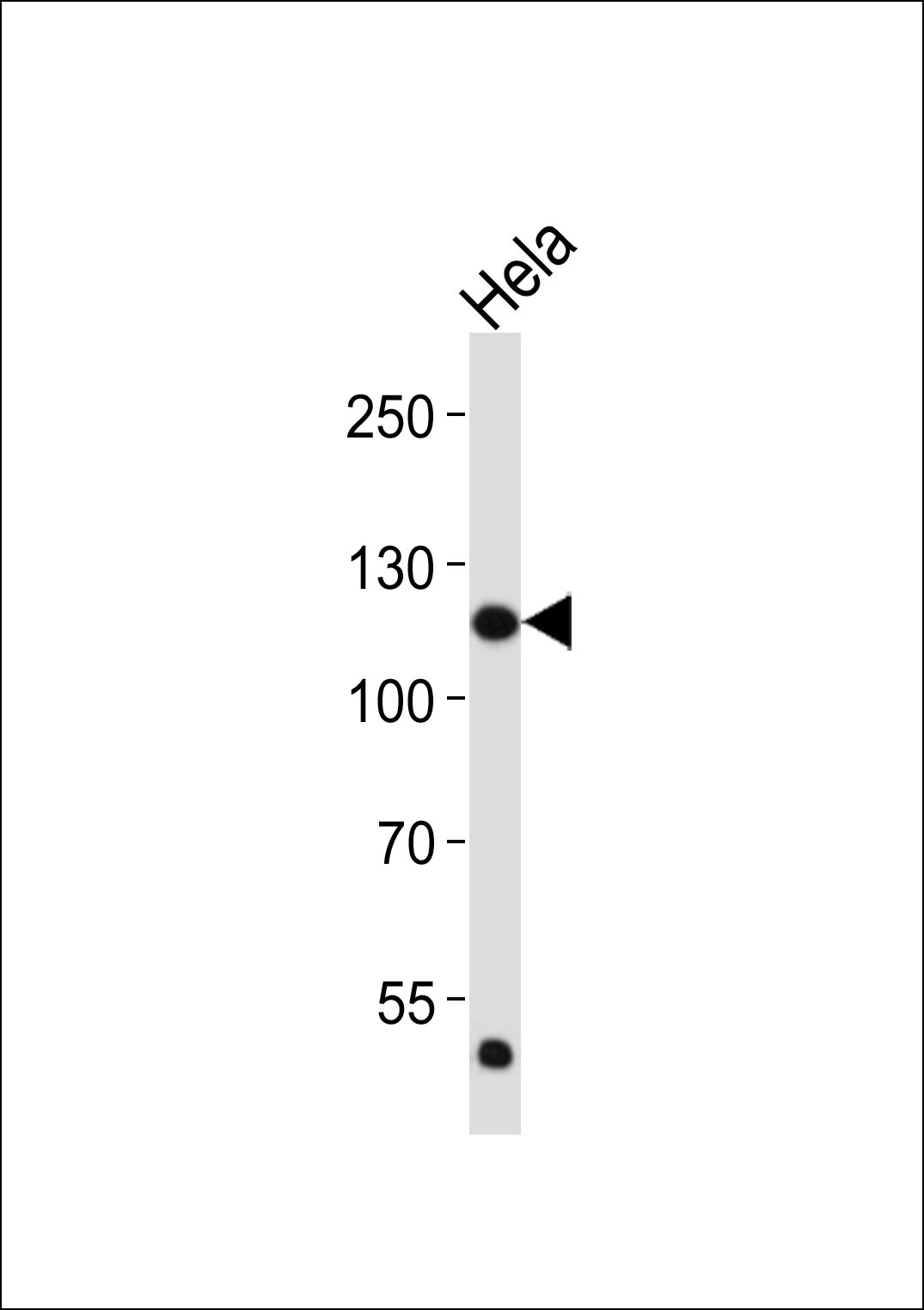 Mouse anti-FGFR1 Monoclonal Antibody(C-term)(1440CT772.50.23)