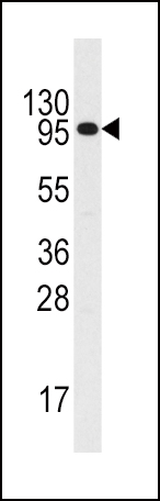 Rabbit anti-IL3R Polyclonal Antibody(C-term V759)