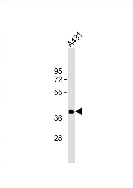 Mouse anti-NMI Monoclonal Antibody(1580CT730.43.59)