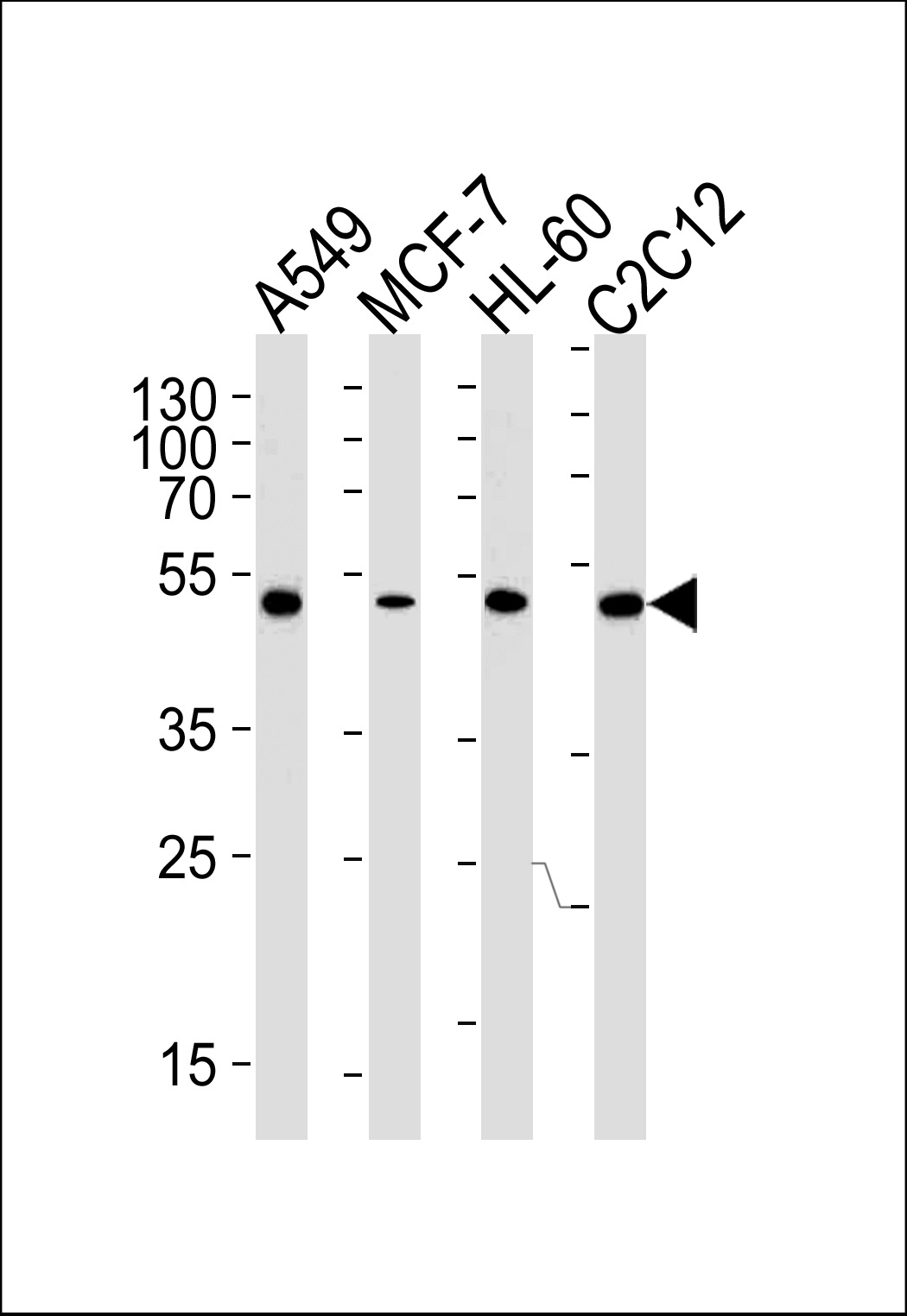 Mouse anti-AVPR1A Monoclonal Antibody(C-term)(721CT25.2.1)