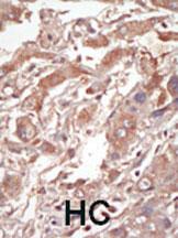 Rabbit anti-LOK Polyclonal Antibody(C-term E707)