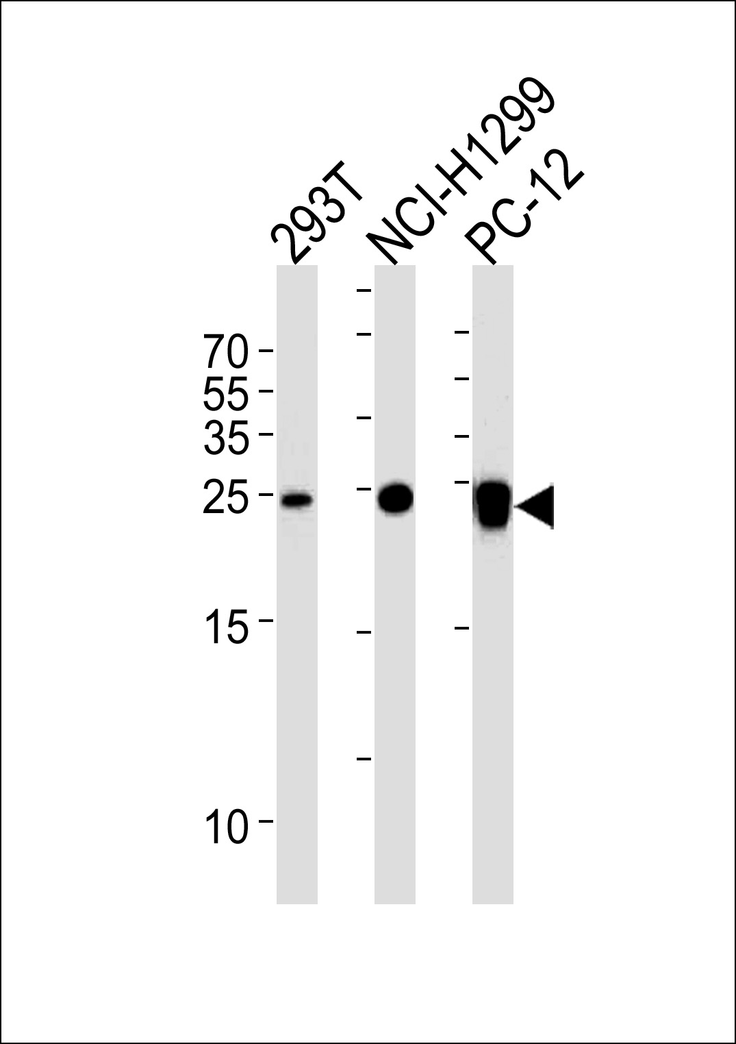 Mouse anti-UCHL1 Monoclonal Antibody(C-term)(696CT2.1.4)