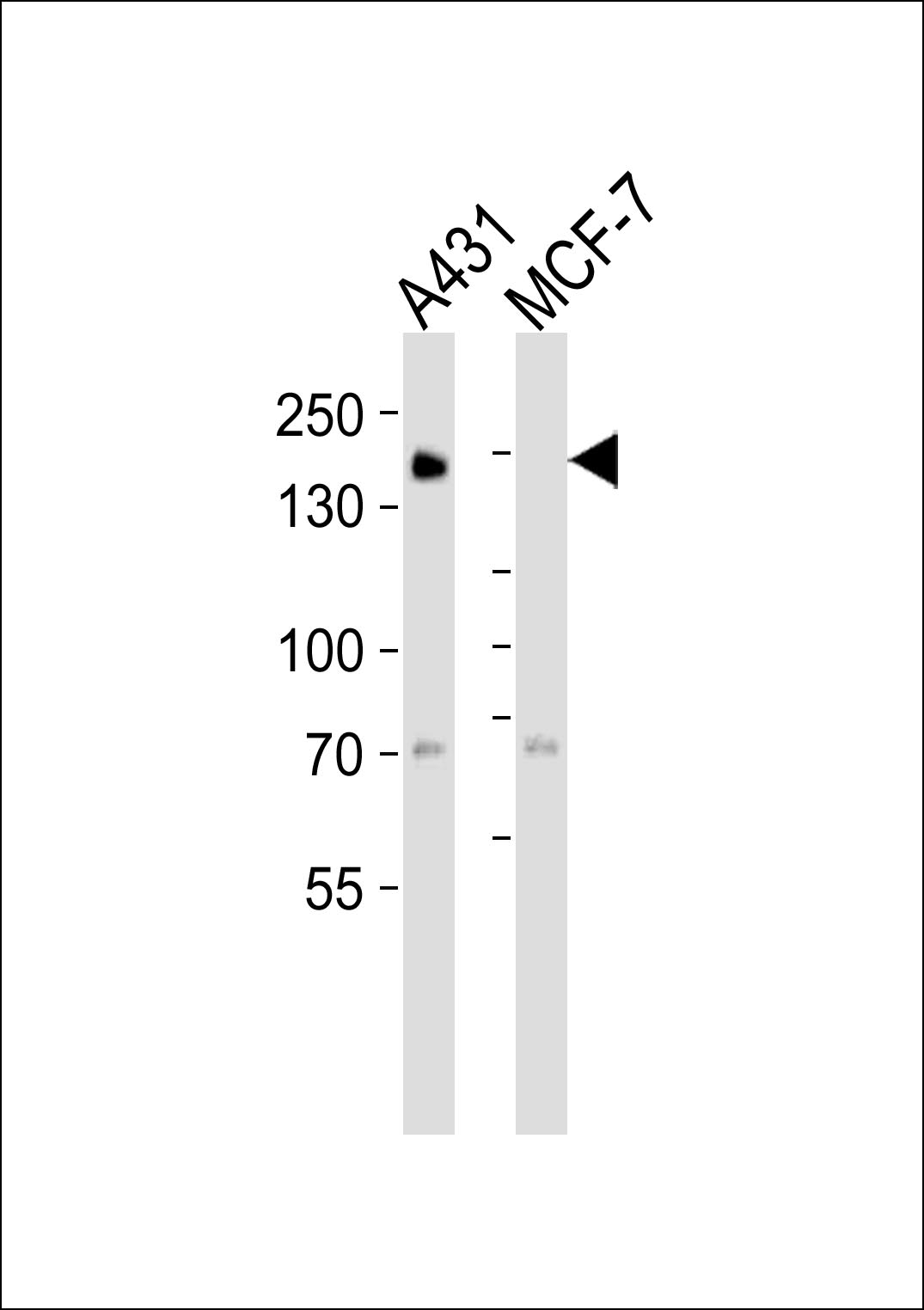 Mouse anti-EGFR Monoclonal Antibody(C-term) (688CT33.1.3)