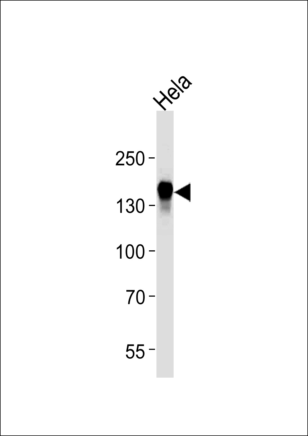 Mouse anti-EGFR Monoclonal Antibody(C-term) (688CT33.1.3)