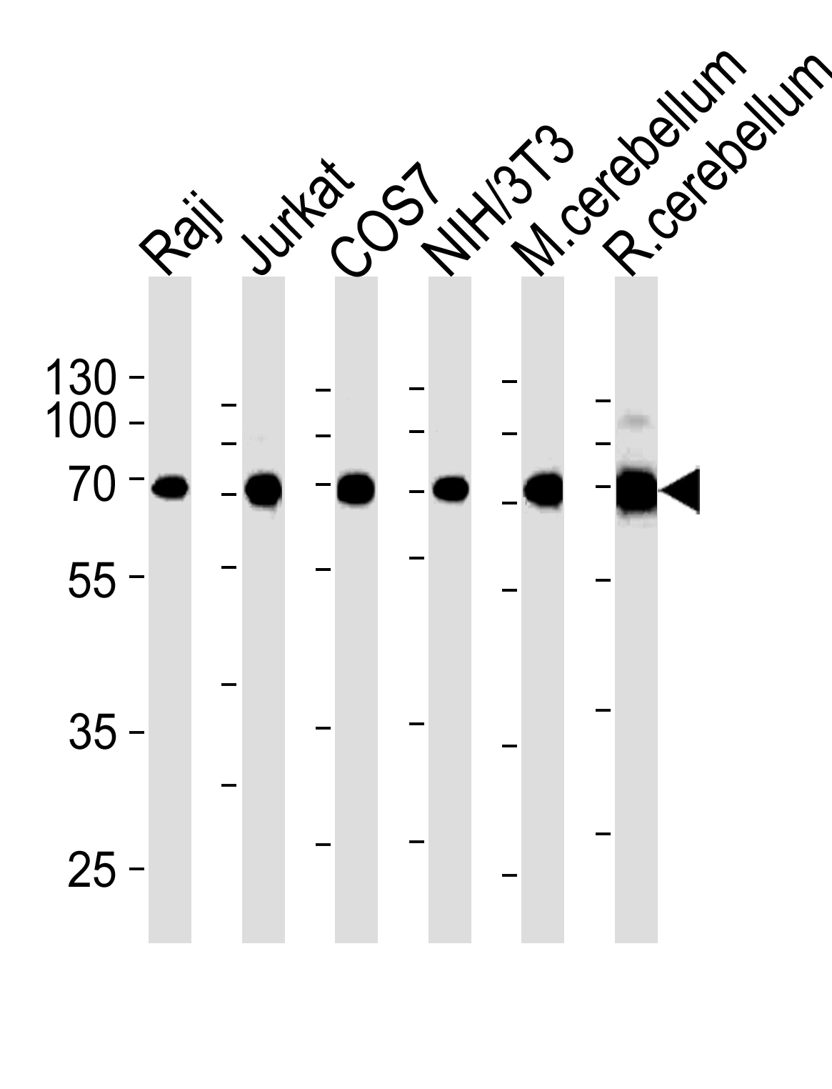 Mouse anti-ACHE Monoclonal Antibody(C-term) (684CT8.3.4)