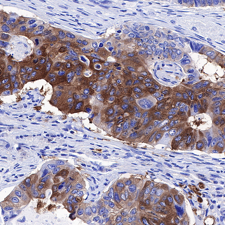 Rabbit anti-FASN Recombinant Monoclonal Antibody(S-682-32)