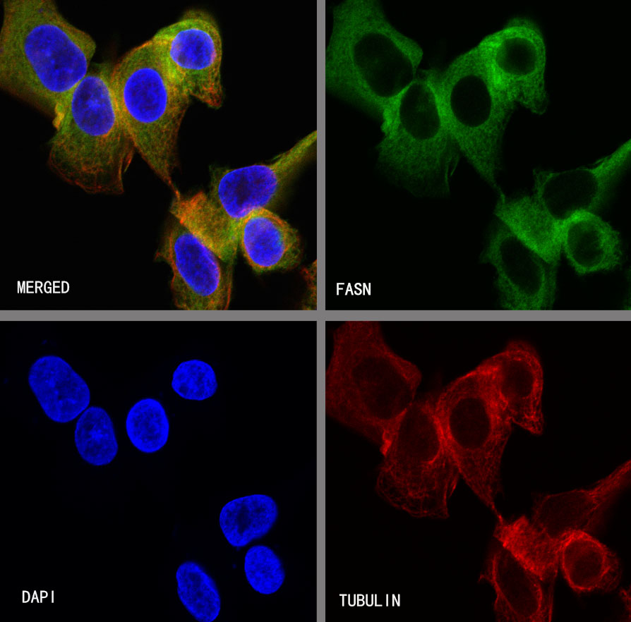 Rabbit anti-FASN Recombinant Monoclonal Antibody(S-682-32)