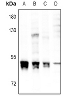 Rabbit anti-PKC α(pS657) Polyclonal Antibody