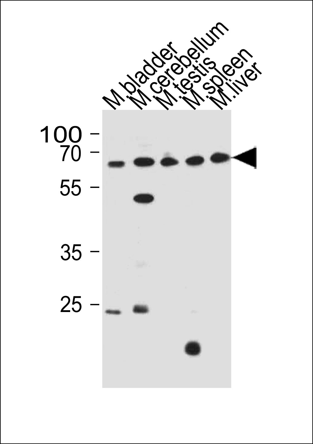 Rabbit anti-ZNF654 Polyclonal Antibody(C-term)