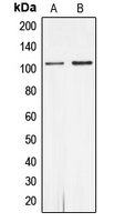 Rabbit anti-Androgen Receptor(pS650) Polyclonal Antibody