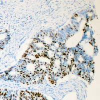 Rabbit anti-Androgen Receptor(pS650) Polyclonal Antibody