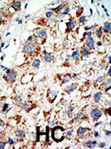 Rabbit anti-SAE2 Polyclonal Antibody(C-term E616)