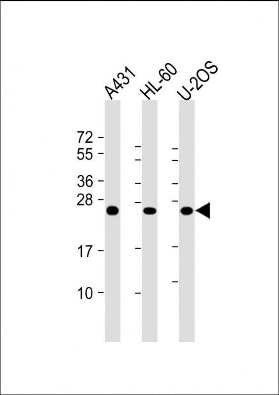 Mouse anti-RAB5C Monoclonal Antibody(1616CT314.65.31)