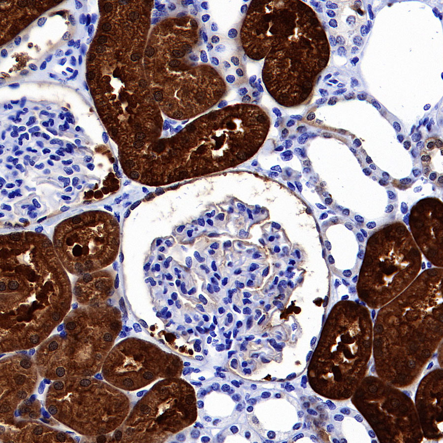 Rabbit anti-sTfR Recombinant Monoclonal Antibody(S-612-12)