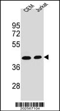 Mouse anti-ADA Monoclonal Antibody(C-term)(608CT2.1.3)